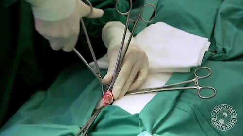 Close-up of surgical procedure showing gloved hands and forceps