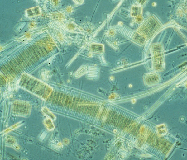Micrograph of Southern Ocean phytoplankton
