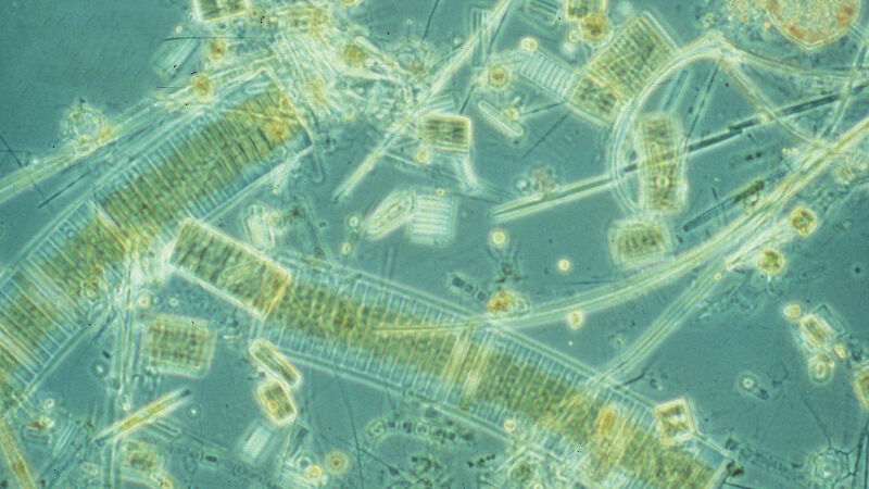 Micrograph of Southern Ocean phytoplankton