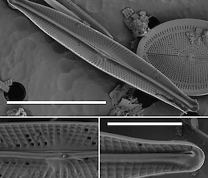 Scanning electron microscope image of internal structure of diatom.