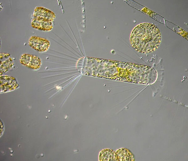 Large diatoms under the microscope.