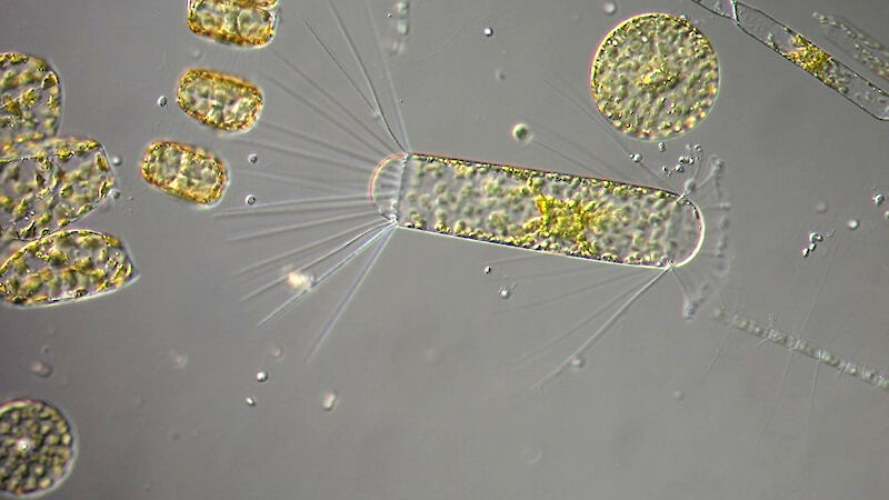 Large diatoms under the microscope.