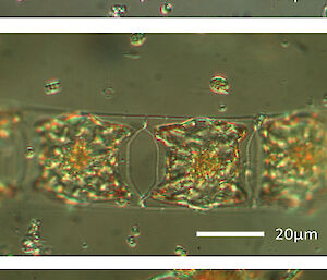 Three different types of diatoms under light microscopy.