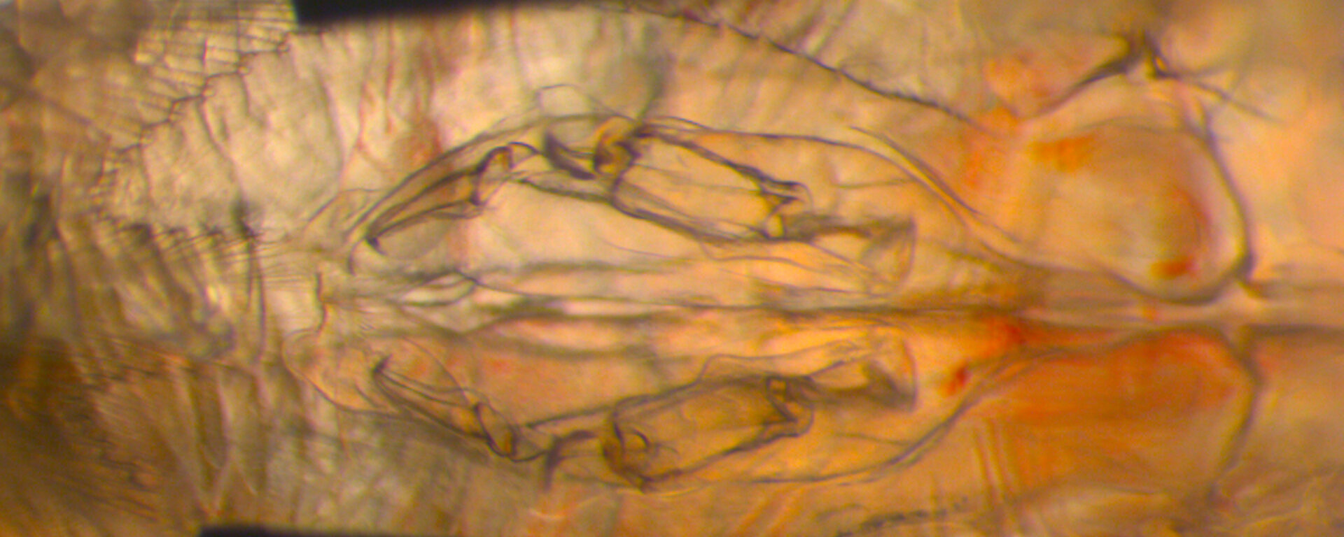 A male krill sexual structure under the microscope.