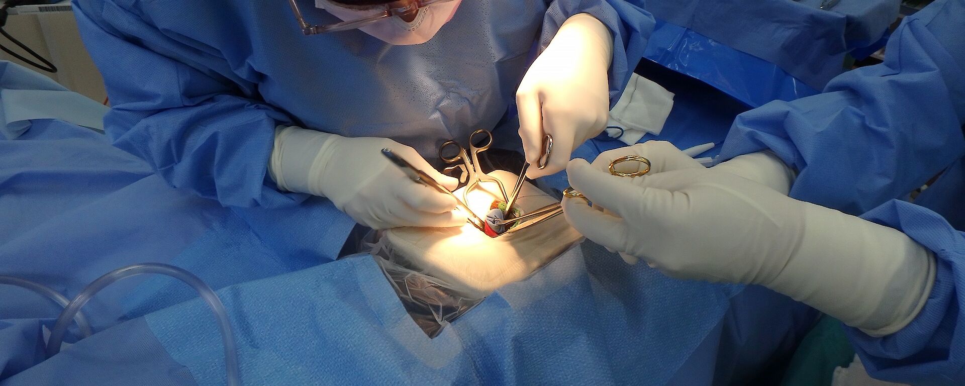 A doctor in scrubs holds surgical equipment to simulate removing an appendix