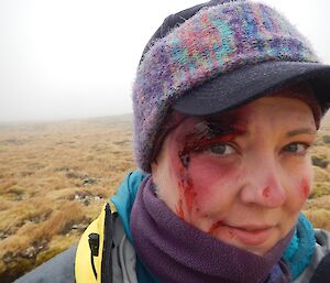 A woman wearing a cap has make up on her face to look like a facial injury