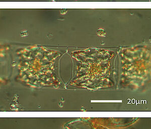 Three different types of diatoms under light microscopy.