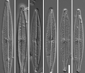 Light microscope and scanning electron microscope images of the canoe-shaped diatom.