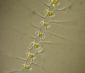 A chain forming diatom under the microscope.