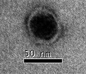 Image of the Organic Lake Virophage