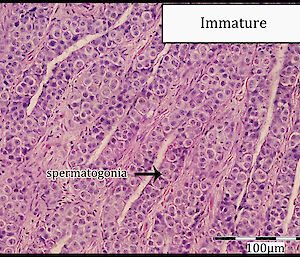 A thin section of immature toothfish testes viewed under the microscope and stained pink and purple