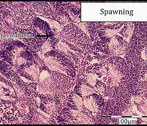 A thin section of spawning testes in a toothfish under the microscope, stained pink and purple