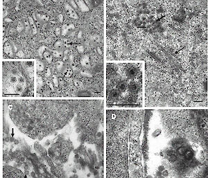 Arboviruses isolated from penguin ticks under transmission electron microscopy.
