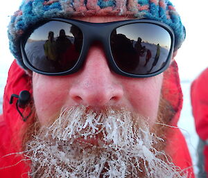 An expeditioner’s beard is covered in a white layer of ice