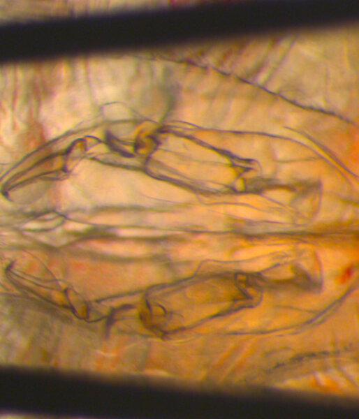 A male krill reproductive structure under the microscope.