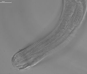 The head of a nematode, or roundworm, under the microscope.