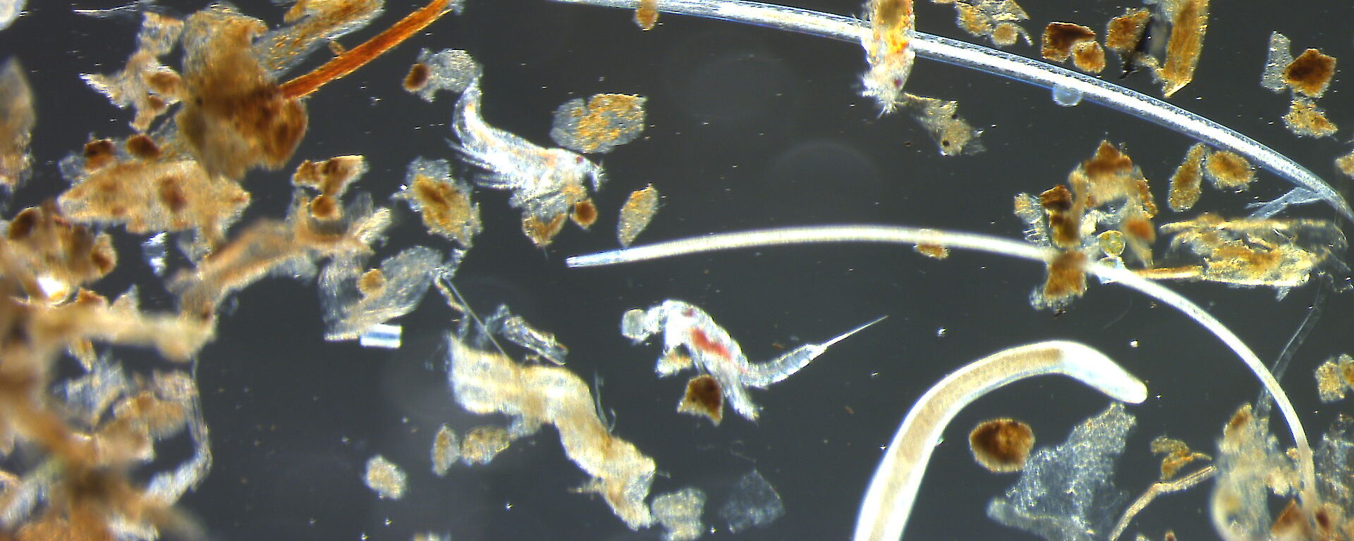 A mixture of nematodes and copepods, isolated from a sediment sample, under the microscope.
