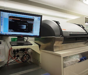 The computerised digital X-ray processor (right) and monitor.