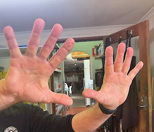 Close up of two clean hands held up in air, kitchen in background